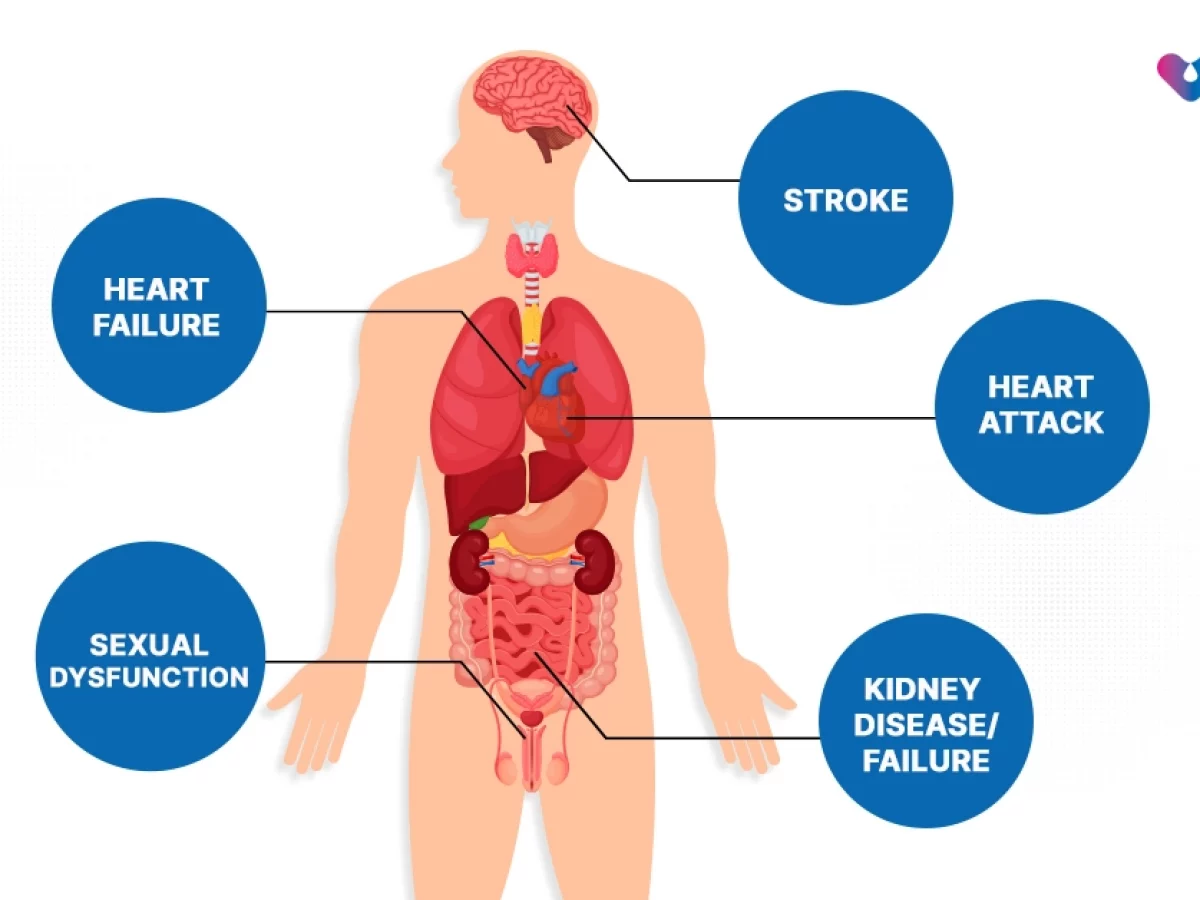 High blood pressure complication image